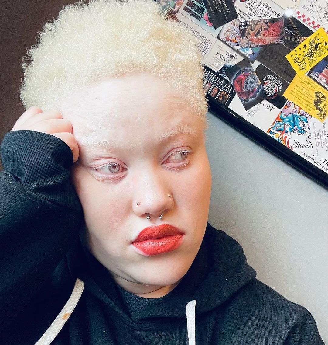 Black woman with blonde hair due to albinism