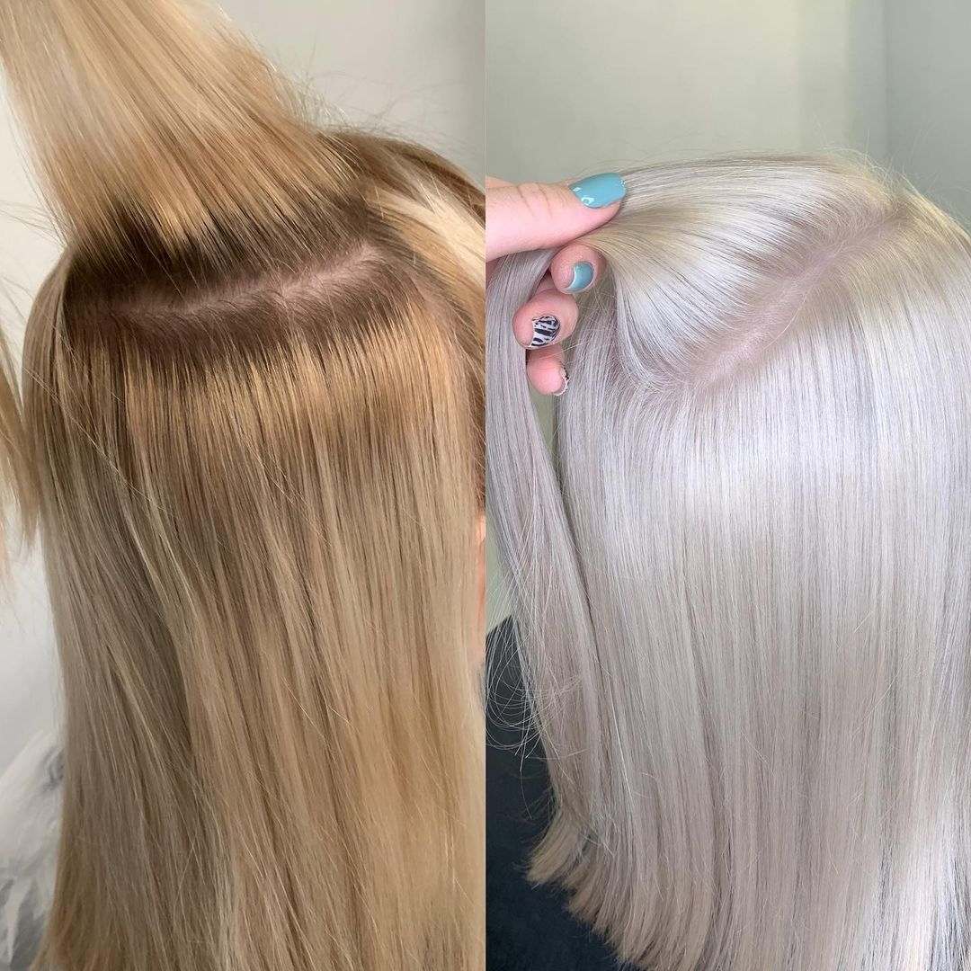 bleaching sessions before and after